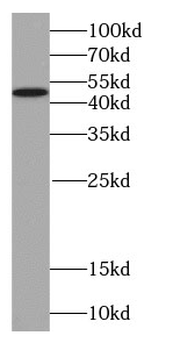 SERPINA10 Mouse Monoclonal Antibody