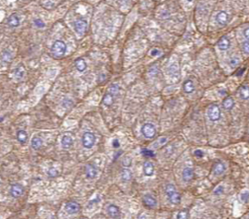SERPINA10 Mouse Monoclonal Antibody