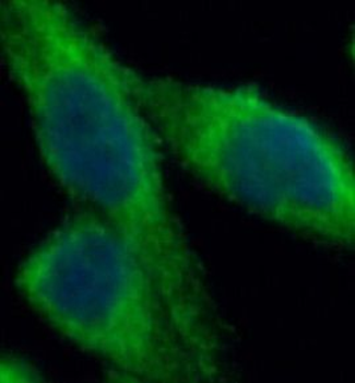 SESN2 Rabbit Polyclonal Antibody