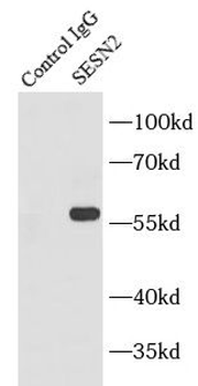SESN2 Rabbit Polyclonal Antibody