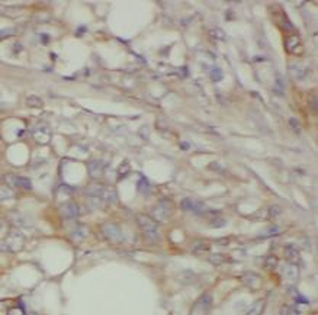 SESN2 Rabbit Polyclonal Antibody