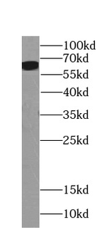 SESN2 Rabbit Polyclonal Antibody