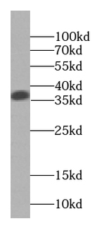 SGTA Mouse Monoclonal Antibody