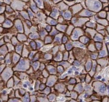 SGTA Mouse Monoclonal Antibody