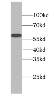 SEPSECS Rabbit Polyclonal Antibody
