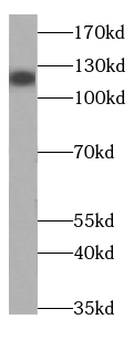 SLC12A5 Specific Rabbit Polyclonal Antibody