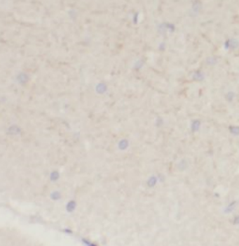SLC12A5 Specific Rabbit Polyclonal Antibody