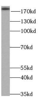 SLIT2 Rabbit Polyclonal Antibody
