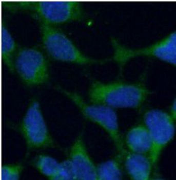 SLIT2 Rabbit Polyclonal Antibody