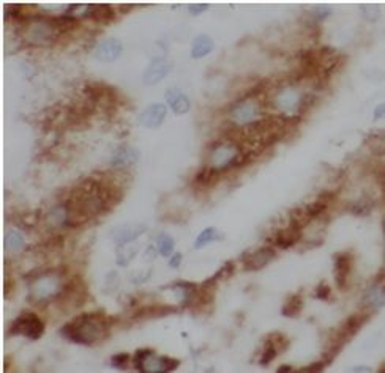 SLIT2 Rabbit Polyclonal Antibody