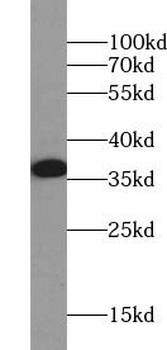 SMN1 Mouse Monoclonal Antibody