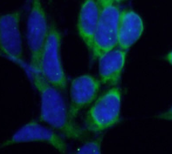 SMN1 Mouse Monoclonal Antibody