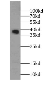 SMN1 (human-Specific) Mouse Monoclonal Antibody