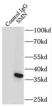 SMN1 (human-Specific) Mouse Monoclonal Antibody