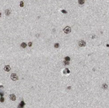 SMN1 (human-Specific) Mouse Monoclonal Antibody