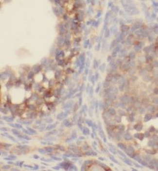 SLC5A5 Antibody