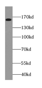 NCOA1 Antibody