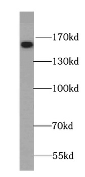 NCOA3 Antibody