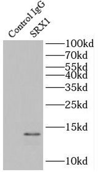 SRXN1 Rabbit Polyclonal Antibody