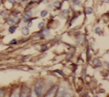 SRXN1 Rabbit Polyclonal Antibody