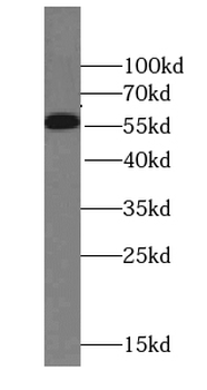 STEAP2 Specific Rabbit Polyclonal Antibody