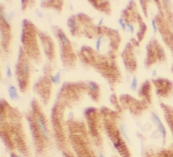 STEAP2 Specific Rabbit Polyclonal Antibody
