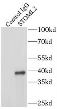 STOML2 Mouse Monoclonal Antibody