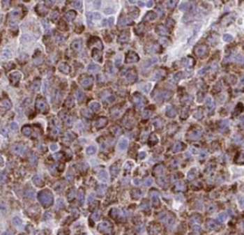 STT3B Rabbit Polyclonal Antibody