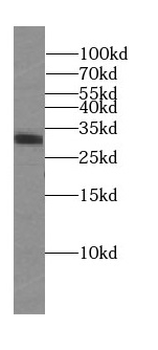 SUMF2 Rabbit Polyclonal Antibody