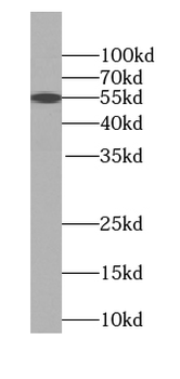 SYNE2 Rabbit Polyclonal Antibody