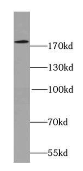 SYNM Rabbit Polyclonal Antibody
