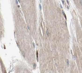 SYNM Rabbit Polyclonal Antibody