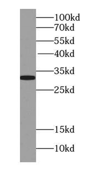STX17 Rabbit Polyclonal Antibody