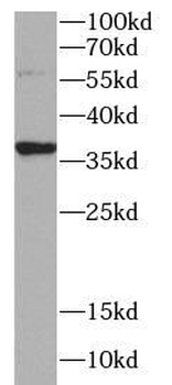 STX7 Rabbit Polyclonal Antibody