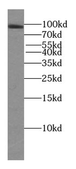 TFIP11 Mouse Monoclonal Antibody