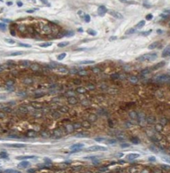 TFIP11 Mouse Monoclonal Antibody