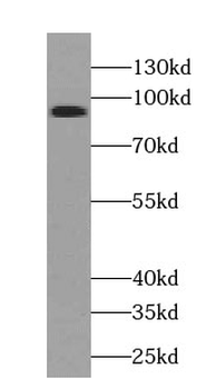 TLE3 Mouse Monoclonal Antibody