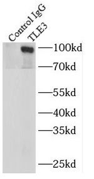 TLE3 Mouse Monoclonal Antibody