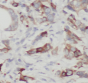 TLE3 Mouse Monoclonal Antibody
