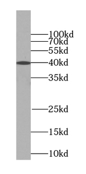 TMEM106B Mouse Monoclonal Antibody