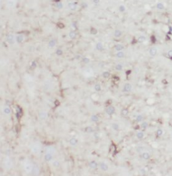 TMEM106B Mouse Monoclonal Antibody