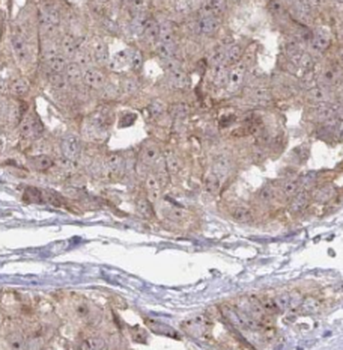 TMF1 Specific Rabbit Polyclonal Antibody