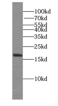 TOMM22 Rabbit Polyclonal Antibody
