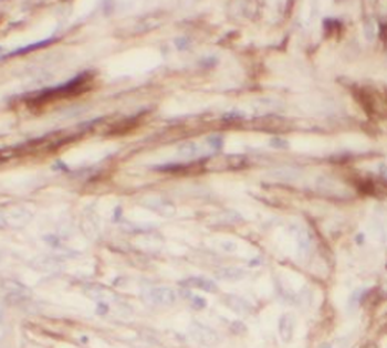 TOMM22 Rabbit Polyclonal Antibody