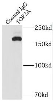 TOP2A Specific Rabbit Polyclonal Antibody