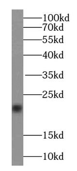 TAGLN2 Antibody