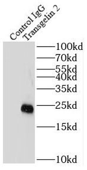 TAGLN2 Antibody