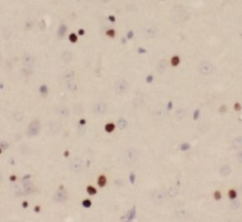 TKT Rabbit Polyclonal Antibody