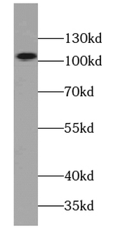 TNPO1 Rabbit Polyclonal Antibody