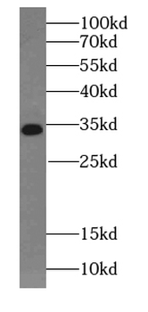 SSR1 Rabbit Polyclonal Antibody
